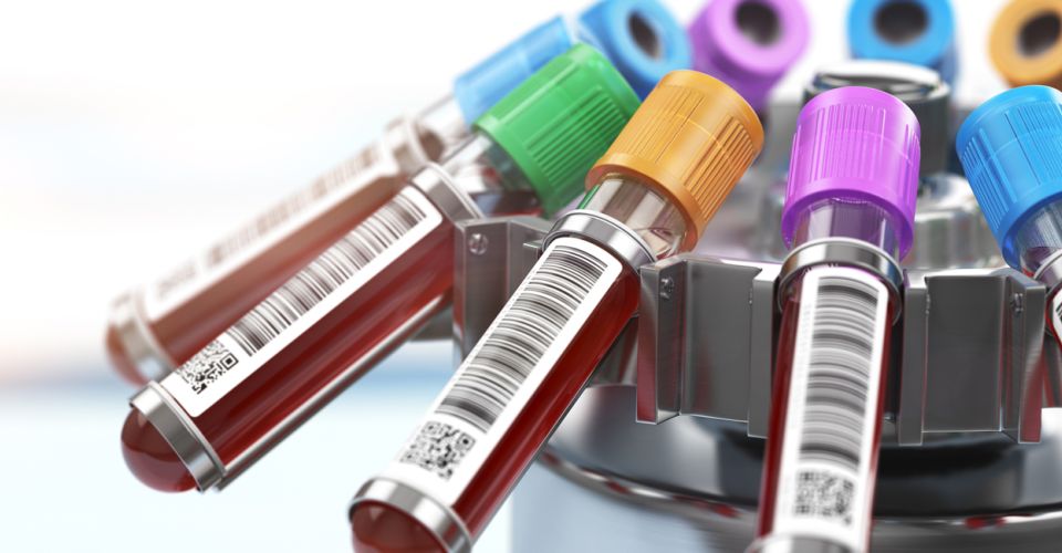 test tubes